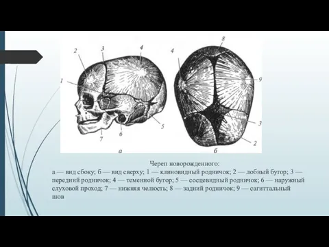 Череп новорожденного: а — вид сбоку; б — вид сверху; 1