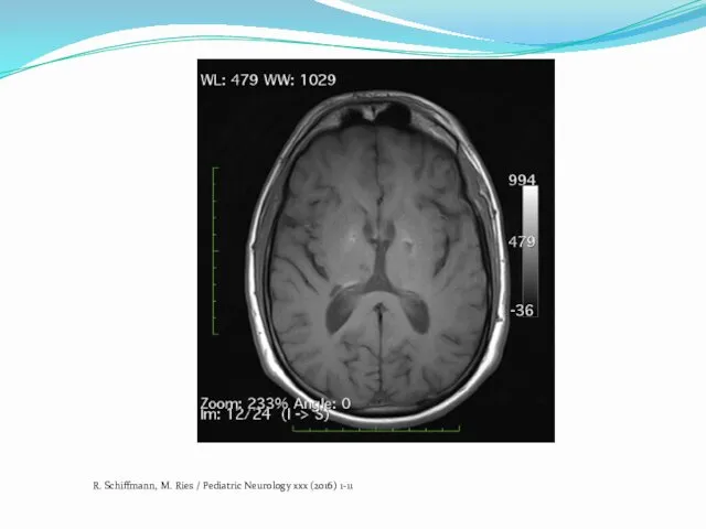 R. Schiffmann, M. Ries / Pediatric Neurology xxx (2016) 1-11