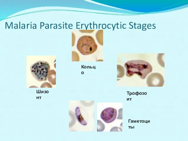 Malaria Parasite Erythrocytic Stages Кольцо Трофозоит Шизонт Гаметоциты