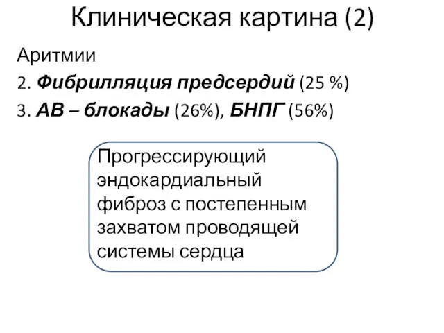 Клиническая картина (2) Аритмии 2. Фибрилляция предсердий (25 %) 3. АВ