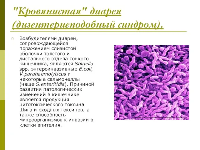 "Кровянистая" диарея (дизентериеподобный синдром). Возбудителями диареи, сопровождающейся поражением слизистой оболочки толстого