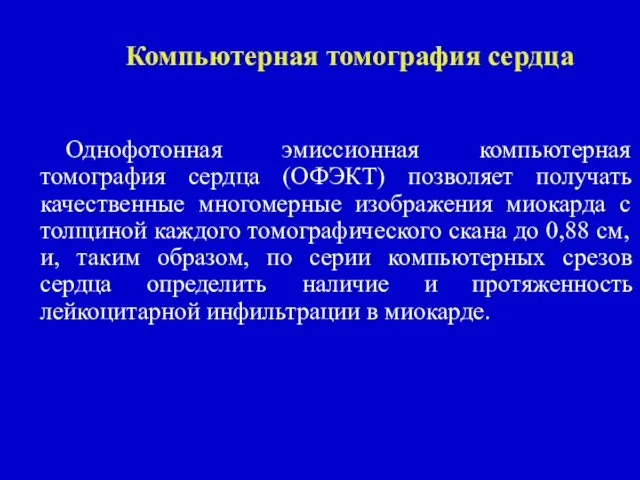 Компьютерная томография сердца Однофотонная эмиссионная компьютерная томография сердца (ОФЭКТ) позволяет получать