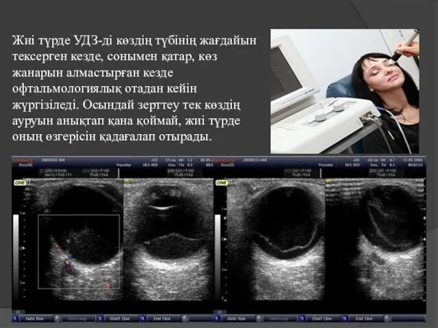 Жиі түрде УДЗ-ді көздің түбінің жағдайын тексерген кезде, сонымен қатар, көз