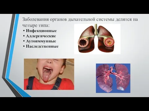 Заболевания органов дыхательной системы делятся на четыре типа: Инфекционные Аллергические Аутоиммунные Наследственные