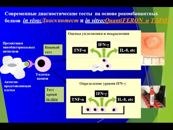 Современные диагностические тесты на основе рекомбинантных белков in vivo:Диаскинтест и in vitro:QuantiFERON и T-SPOT