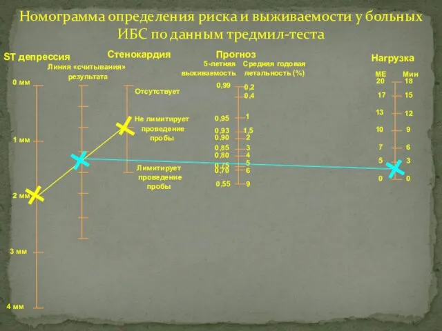 Номограмма определения риска и выживаемости у больных ИБС по данным тредмил-теста