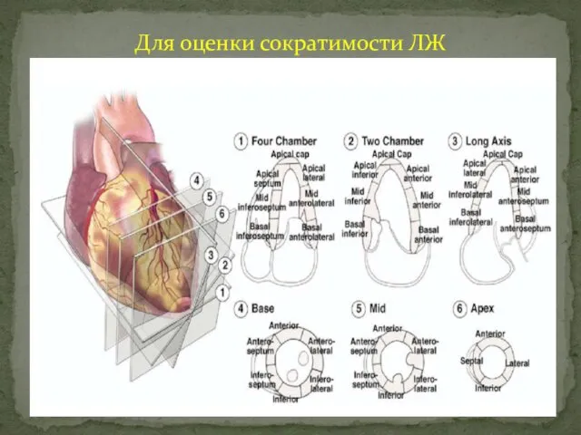 Для оценки сократимости ЛЖ