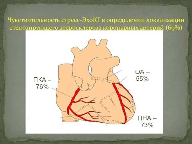 Чувствительность стресс-ЭхоКГ в определении локализации стенозирующего атеросклероза коронарных артерий (69%) ПКА