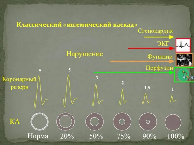 Классический «ишемический каскад» 5 5 Норма 20% 50% 75% 90% 100%