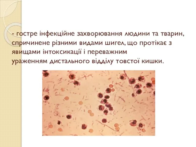 - гостре інфекційне захворювання людини та тварин, спричинене різними видами шигел,