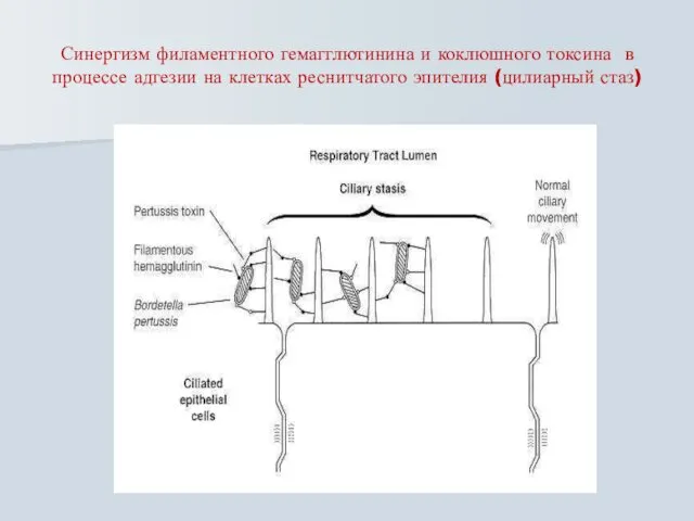 Синергизм филаментного гемагглютинина и коклюшного токсина в процессе адгезии на клетках реснитчатого эпителия (цилиарный стаз)