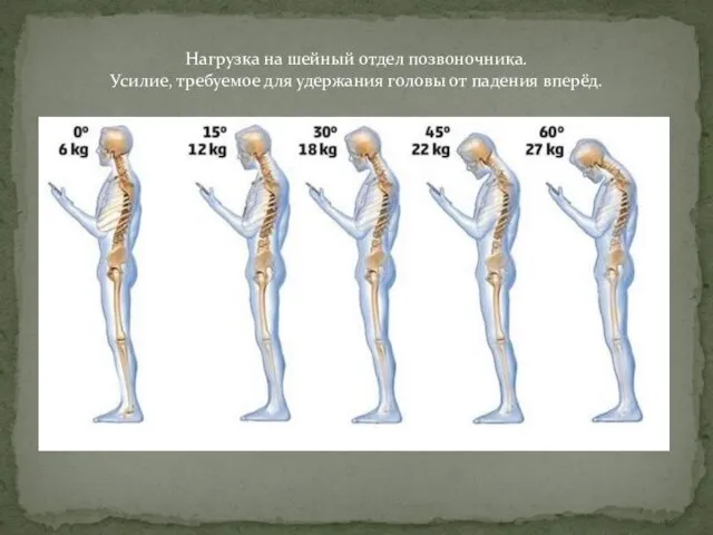 Нагрузка на шейный отдел позвоночника. Усилие, требуемое для удержания головы от падения вперёд.