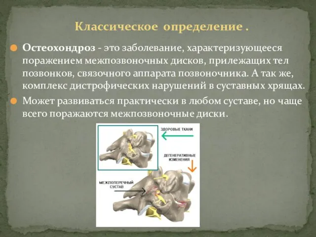 Классическое определение . Остеохондроз - это заболевание, характеризующееся поражением межпозвоночных дисков,