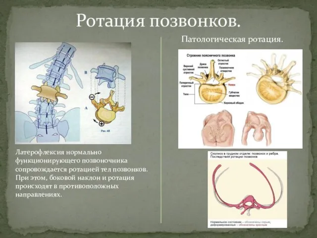 Ротация позвонков. Латерофлексия нормально функционирующего позвоночника сопровождается ротацией тел позвонков. При