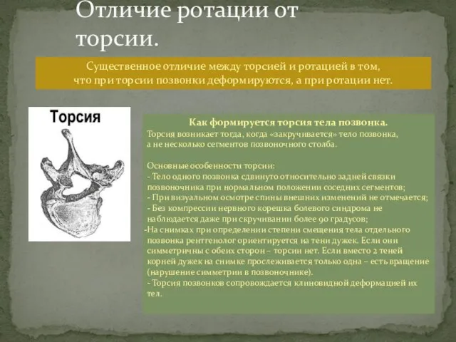 Как формируется торсия тела позвонка. Торсия возникает тогда, когда «закручивается» тело