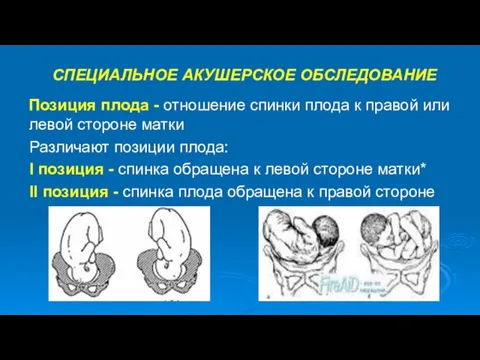 СПЕЦИАЛЬНОЕ АКУШЕРСКОЕ ОБСЛЕДОВАНИЕ Позиция плода - отношение спинки плода к правой