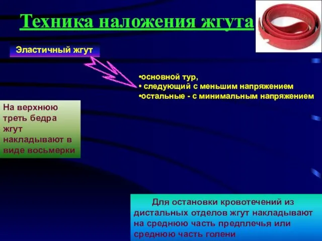 Техника наложения жгута Эластичный жгут Для остановки кровотечений из дистальных отделов