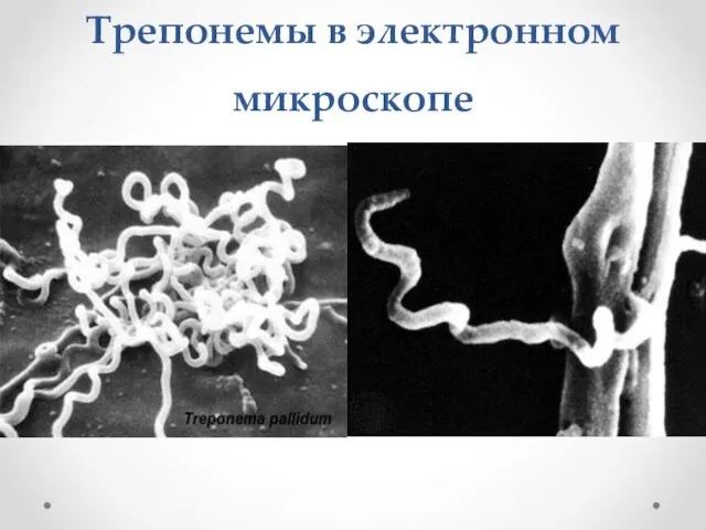 Трепонемы в электронном микроскопе