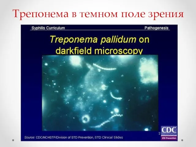 Трепонема в темном поле зрения