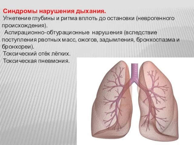 Синдромы нарушения дыхания. Угнетение глубины и ритма вплоть до остановки (неврогенного