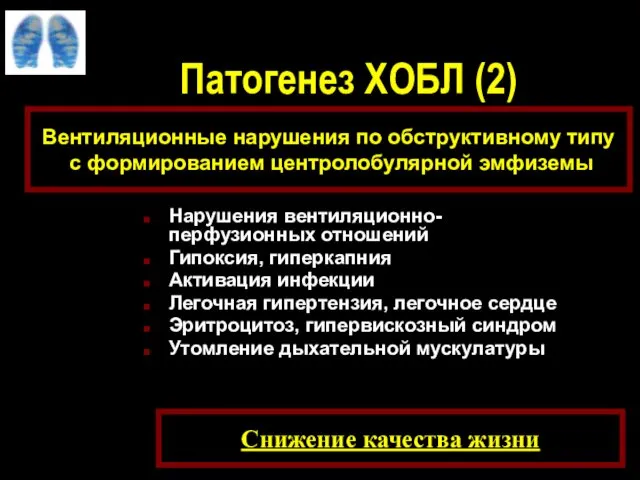 Патогенез ХОБЛ (2) Нарушения вентиляционно-перфузионных отношений Гипоксия, гиперкапния Активация инфекции Легочная