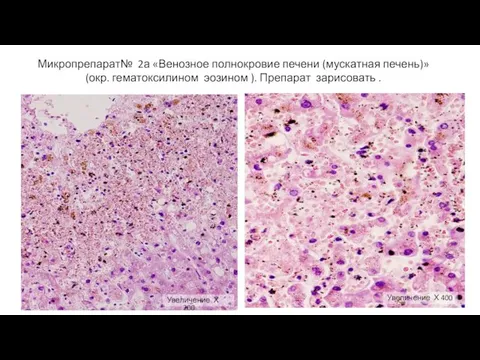 Микропрепарат№ 2а «Венозное полнокровие печени (мускатная печень)» (окр. гематоксилином эозином ).