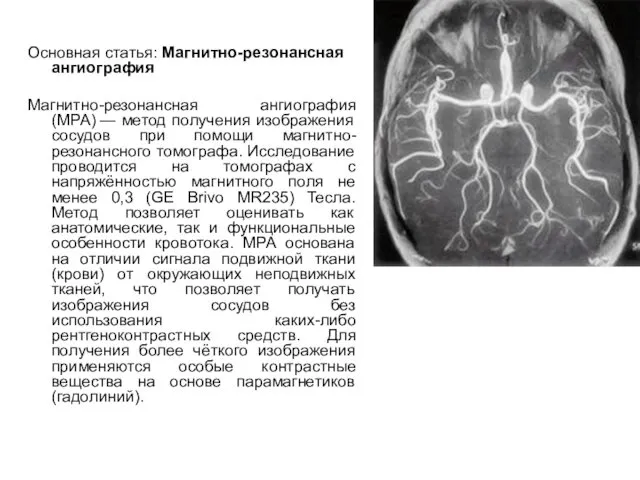 Основная статья: Магнитно-резонансная ангиография Магнитно-резонансная ангиография (МРА) — метод получения изображения