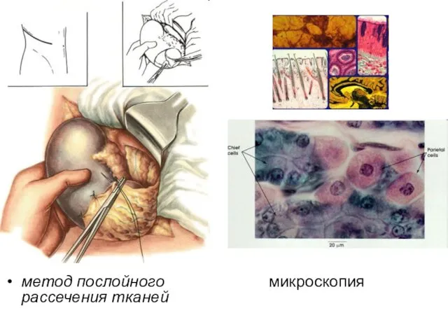 метод послойного микроскопия рассечения тканей