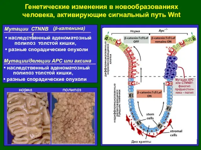 Генетические изменения в новообразованиях человека, активирующие сигнальный путь Wnt Мутации/делеции АРС