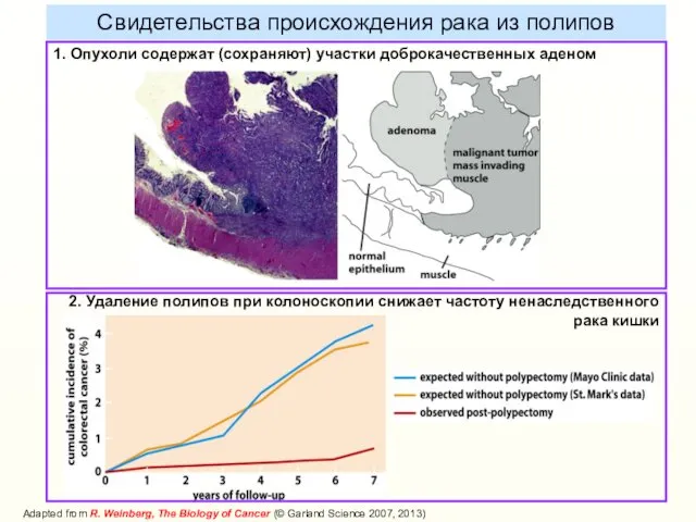 Свидетельства происхождения рака из полипов 1. Опухоли содержат (сохраняют) участки доброкачественных