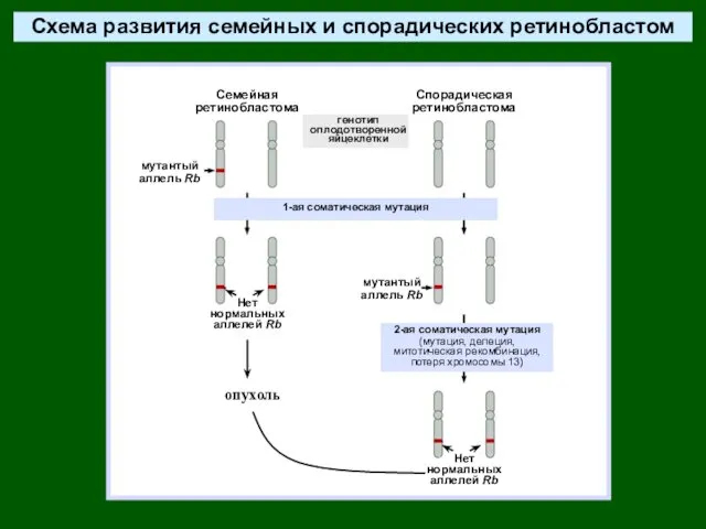 Схема развития семейных и спорадических ретинобластом