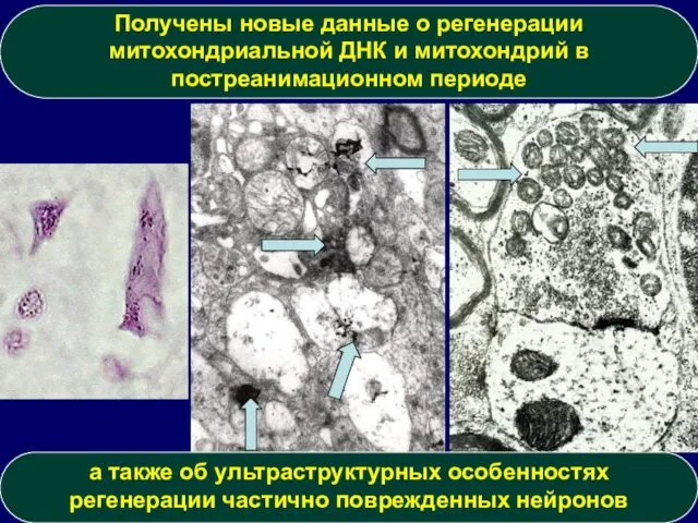 Получены новые данные о регенерации митохондриальной ДНК и митохондрий в постреанимационном