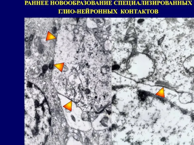 РАННЕЕ НОВООБРАЗОВАНИЕ СПЕЦИАЛИЗИРОВАННЫХ ГЛИО-НЕЙРОННЫХ КОНТАКТОВ
