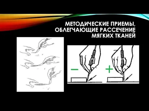 МЕТОДИЧЕСКИЕ ПРИЕМЫ, ОБЛЕГЧАЮЩИЕ РАССЕЧЕНИЕ МЯГКИХ ТКАНЕЙ