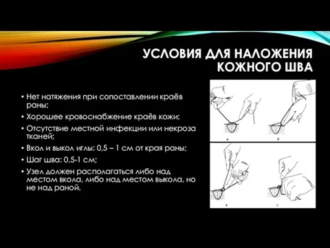 УСЛОВИЯ ДЛЯ НАЛОЖЕНИЯ КОЖНОГО ШВА Нет натяжения при сопоставлении краёв раны;