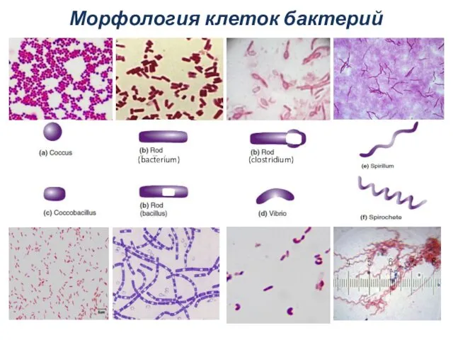 Морфология клеток бактерий (bacterium) (clostridium)