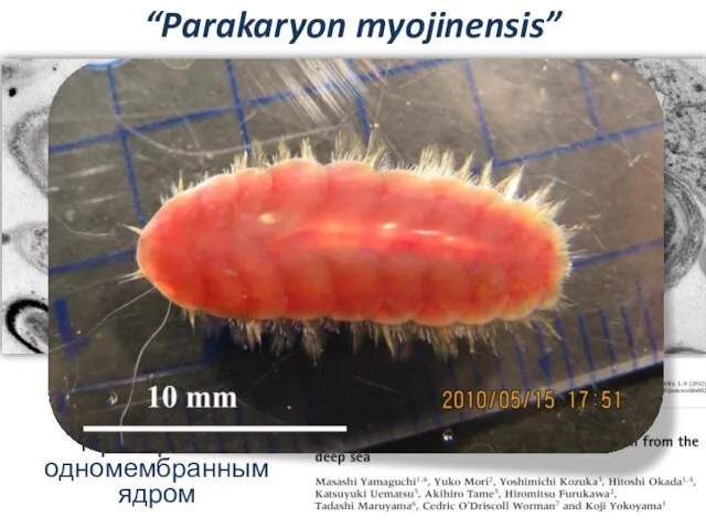 Слайд “Parakaryon myojinensis” Прокариот с одномембранным ядром