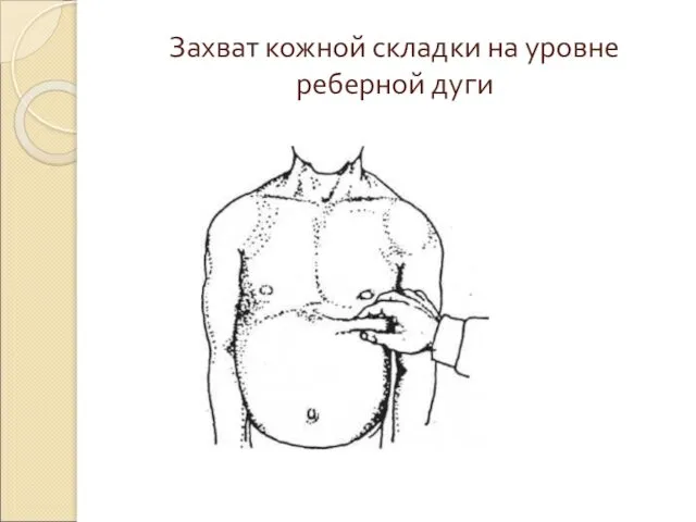 Захват кожной складки на уровне реберной дуги