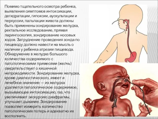 Помимо тщательного осмотра ребенка, выявления симптомов интоксикации, дегидратации, гипоксии, аускультации и