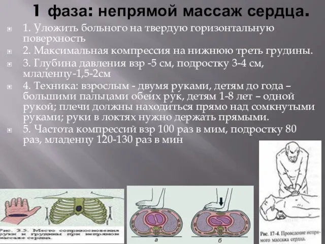 1 фаза: непрямой массаж сердца. 1. Уложить больного на твердую горизонтальную