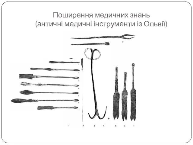 Поширення медичних знань (античні медичні інструменти із Ольвії)