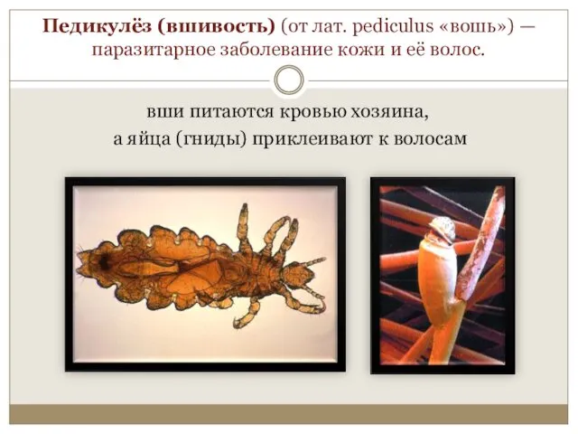 Педикулёз (вшивость) (от лат. pediculus «вошь») — паразитарное заболевание кожи и