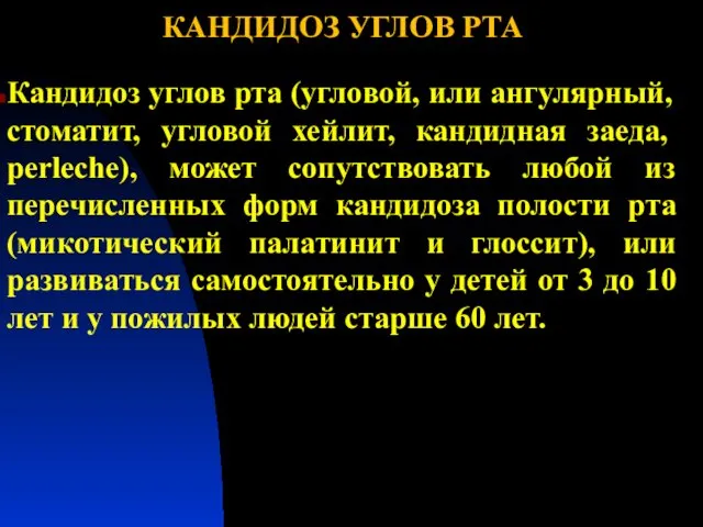 КАНДИДОЗ УГЛОВ РТА Кандидоз углов рта (угловой, или ангулярный, стоматит, угловой