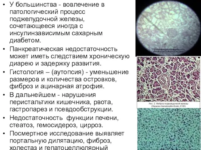 У большинства - вовлечение в патологический процесс поджелудочной железы, сочетающееся иногда