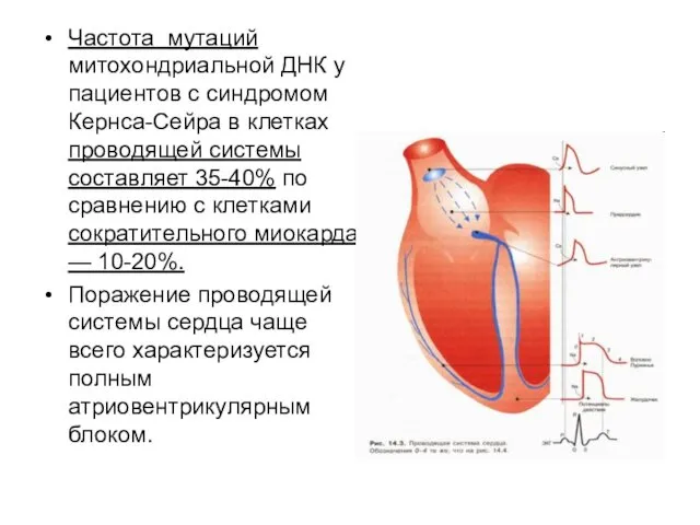 Частота мутаций митохондриальной ДНК у пациентов с синдромом Кернса-Сейра в клетках