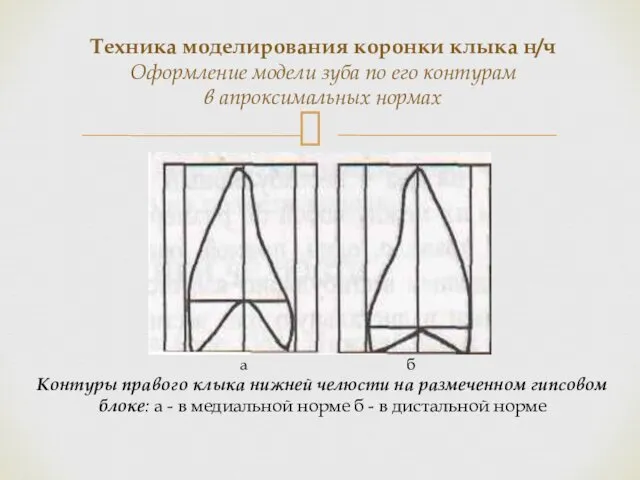 Контуры правого клыка нижней челюсти на размеченном гипсовом блоке: а -