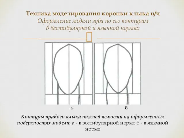 Контуры правого клыка нижней челюсти на оформленных поверхностях модели: а -