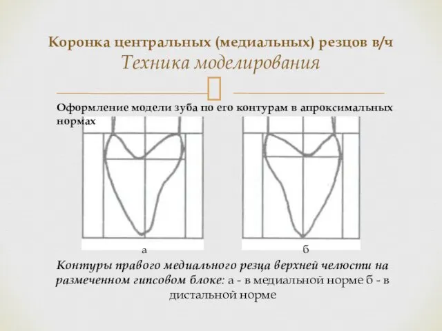 Коронка центральных (медиальных) резцов в/ч Техника моделирования Контуры правого медиального резца