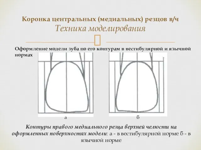 Коронка центральных (медиальных) резцов в/ч Техника моделирования Контуры правого медиального резца