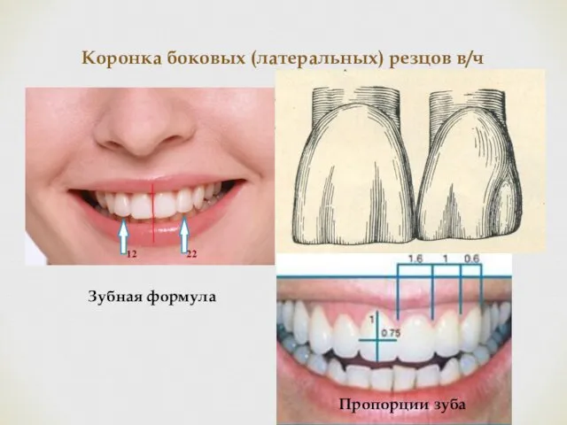 Коронка боковых (латеральных) резцов в/ч Пропорции зуба Зубная формула